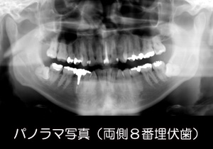 歯・顎骨